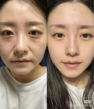 マツエク・マツパ 愛維美水光専門店 川崎彩鳳のエステ・リラクイメージ