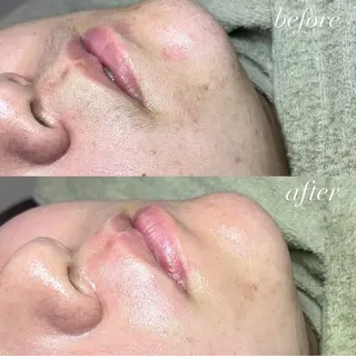 beauty salonWのエステ・リラクイメージ