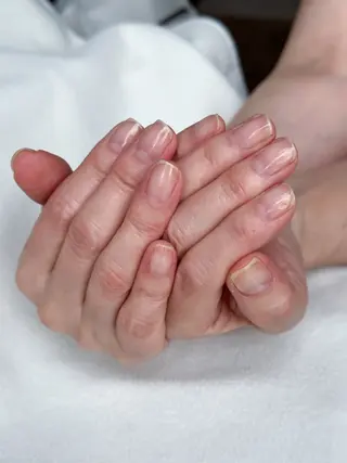ネイル fote-自爪育成 ネイルケアサロン-のネイルデザイン
