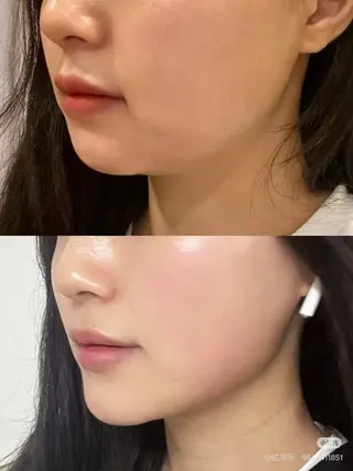 ネイル 愛維美水光専門店 川崎彩鳳のエステ・リラクイメージ