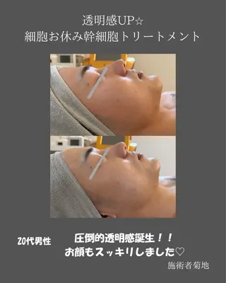 BLOSSOM 菊地のエステ・リラクイメージ