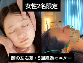小顔美容鍼 渋谷 YZ 山崎のエステ・リラクイメージ
