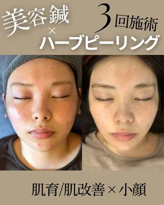 恵比寿/代官山 鍼灸師/根本亮佑のエステ・リラクイメージ
