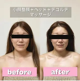 小顔＆美肌 Re :setのエステ・リラクイメージ