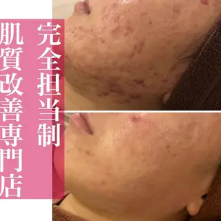ミディアム カラー パーマ ヘアアレンジ メンズ キッズ ネイル マツエク・マツパ ニキビ・肌質改善専門 ♡人生が変わるサロンのエステ・リラクイメージ