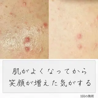 ニキビ経験者が施術 する専門サロン🌻のエステ・リラクイメージ