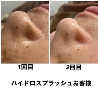ネイル・エステサロン UILANIのエステ・リラクイメージ