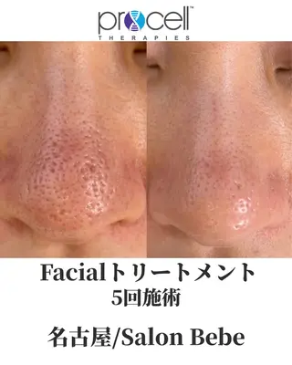 Salon Bebe 名古屋のエステ・リラクイメージ