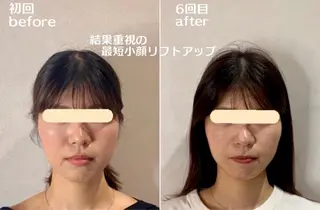 ショート 愛維美水光専門店 川崎彩鳳のエステ・リラクイメージ