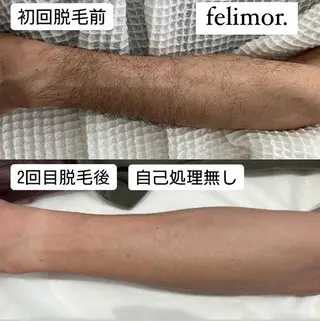 Felimor. フェリモールのエステ・リラクイメージ