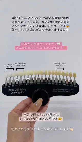 ホワイトニング 獅子🦁店長のその他イメージ