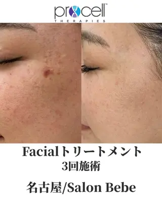 Salon Bebe 名古屋のエステ・リラクイメージ