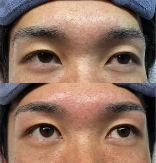 アイブロウ トータルビューティー サロン・Ｎの眉毛・アイブロウイメージ