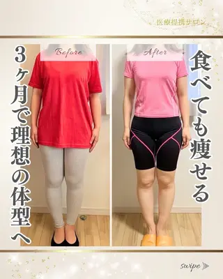 美人スイッチdiet スーパージェクションのその他イメージ