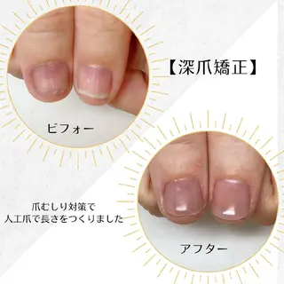 ネイル ネイルサロン アリュームのネイルデザイン