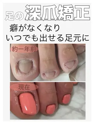 ネイル nail salon petillantのネイルデザイン