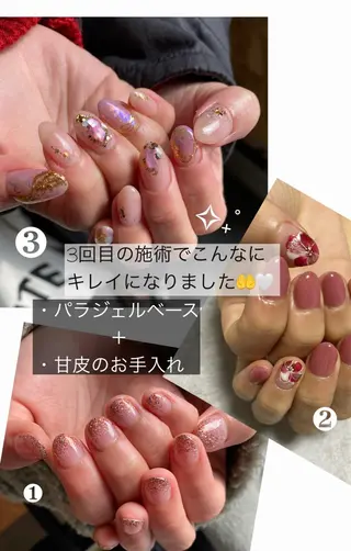 ネイル nailsalon ∞ ﾐｶﾅﾙ ∞のネイルデザイン