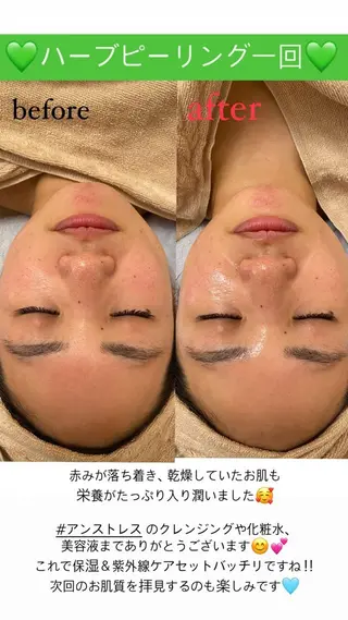 Salon de Lino 御器所のエステ・リラクイメージ