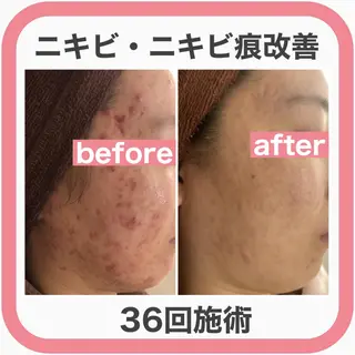 ミディアム カラー パーマ ヘアアレンジ メンズ キッズ ネイル マツエク・マツパ ニキビ・肌質改善専門 ♡人生が変わるサロンのエステ・リラクイメージ