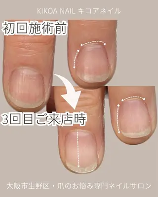 ネイル KIKOA NAIL キコアネイルのネイルデザイン
