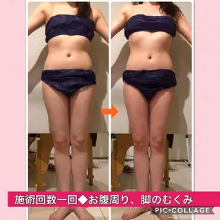ショート カラー パーマ ヘアアレンジ メンズ キッズ ネイル マツエク・マツパ 痩身&ボディ 結果出し🌟丹野のエステ・リラクイメージ