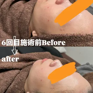 Smoo アユミの眉毛・アイブロウイメージ