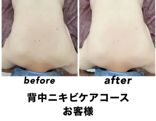 ネイル・エステサロン UILANIのエステ・リラクイメージ