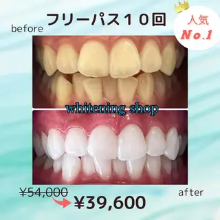 ホワイトニング ショップ葛西店のその他イメージ