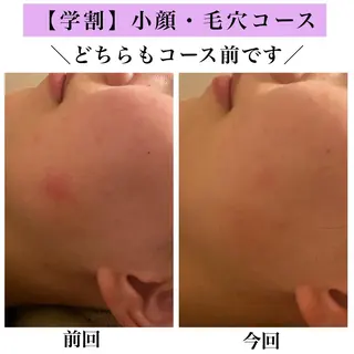 Bellesthe (ベルエステ)のエステ・リラクイメージ