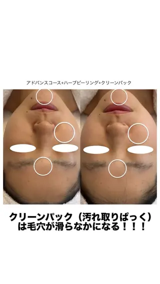 フェイシャルエステ 🎀　naoのエステ・リラクイメージ