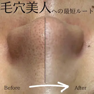🌷MURA 毛穴・顔脱毛🌷のエステ・リラクイメージ