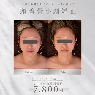 kogao&head Linoasのエステ・リラクイメージ