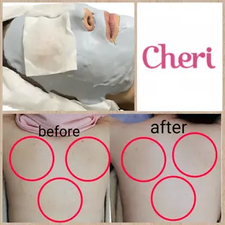 肌ケア&毛穴洗浄 Cheri/女性専用のエステ・リラクイメージ