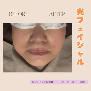 lieupré 脱毛 oshima⌣̈のエステ・リラクイメージ