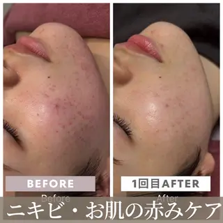 池田 桃花のエステ・リラクイメージ