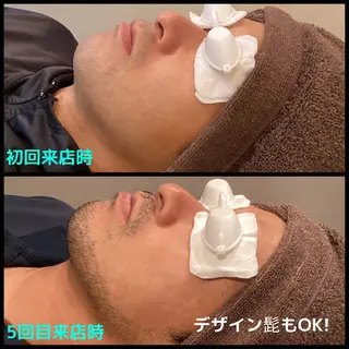 メンズ men's脱毛サロン ECXIAのエステ・リラクイメージ