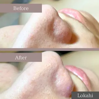 脱毛サロン Lokahiのエステ・リラクイメージ