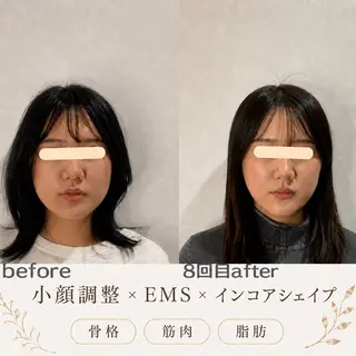 最速小顔・肌管理 espoir 阿部のエステ・リラクイメージ