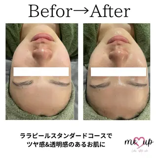Meupニキビ専門店 背中/ハーブ/肌管理のその他イメージ