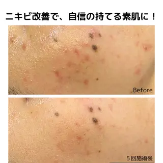 leolo武蔵浦和 肌質改善&脱毛のエステ・リラクイメージ