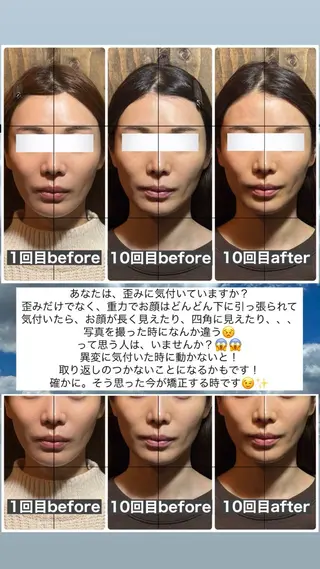 💎後悔させない小顔 矯正💎イトヤマ🌱のエステ・リラクイメージ