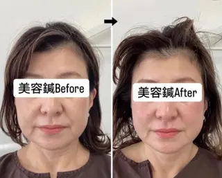 美容鍼灸×小顔整体♡ ハリサロンドオフ堺東のその他イメージ