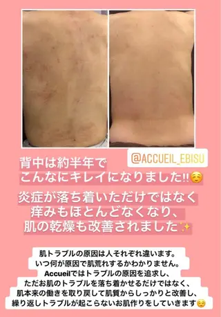 ミディアム カラー パーマ ヘアアレンジ メンズ キッズ ネイル マツエク・マツパ ニキビ・肌質改善専門 ♡人生が変わるサロンのエステ・リラクイメージ