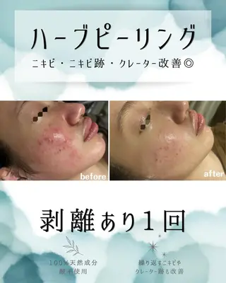 医療提携 肌管理痩身エステ池袋のエステ・リラクイメージ