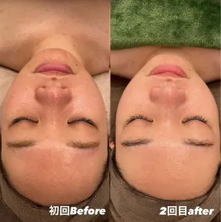 Dioe 自由が丘のエステ・リラクイメージ