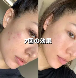 川﨑 杏莉のエステ・リラクイメージ