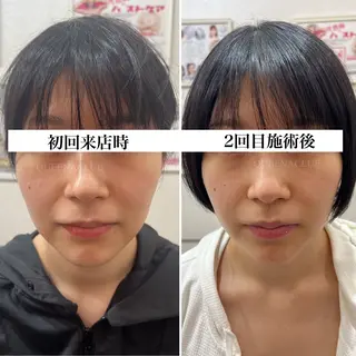 毛穴改善/脱毛 ネイル 川上久仁子のエステ・リラクイメージ