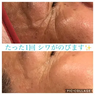 セミロング カラー パーマ ヘアアレンジ キッズ ネイル マツエク・マツパ EnsorClair 代表 野口真央のエステ・リラクイメージ