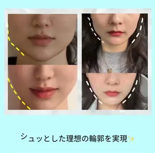 愛維美水光美肌専門店 メンズレディースokのエステ・リラクイメージ
