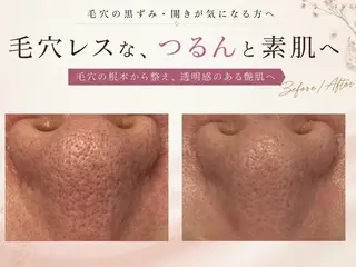 小顔/毛穴/ニキビ salon bealのエステ・リラクイメージ